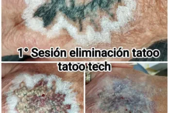 Estética Avanzada LANA BERNADINI